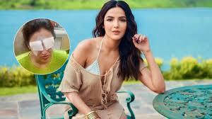 Jasmin Bhasin Reveals Lens Mishap Damaged Her Corneas, Says ‘I Am In A Lot Of Pain’.